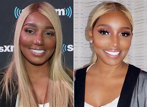 nene leaks before surgery|NeNe Leakes Plastic Surgery: Before, After Photos